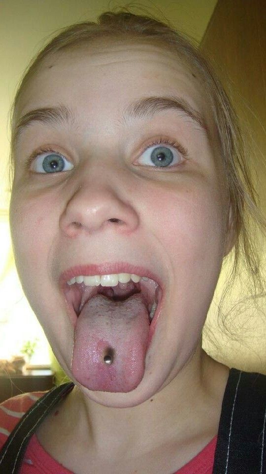 Open mouth