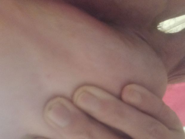 My asshole