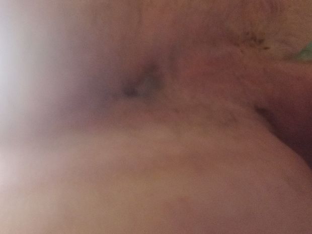 My asshole