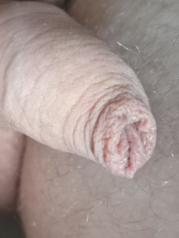 Foreskin close picture