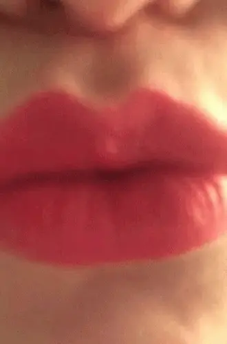 Kisses