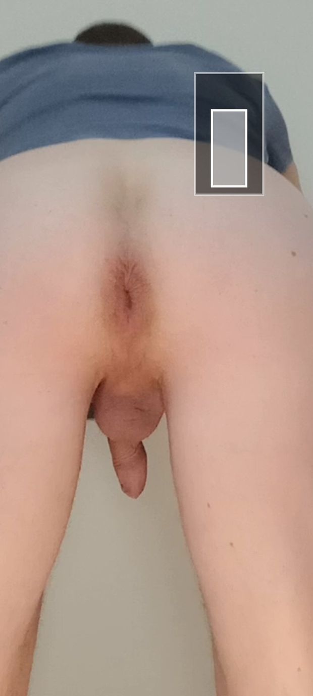 My asshole