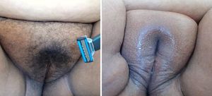 BBW Before/After Shaved