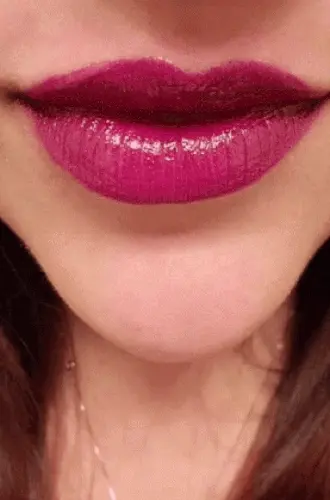 Kiss