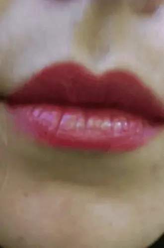 Kisses
