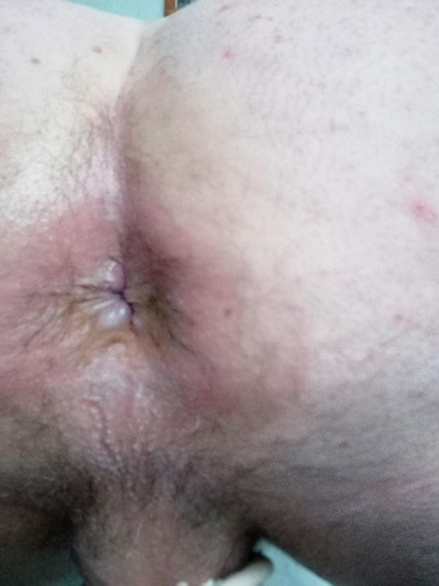 Me ass