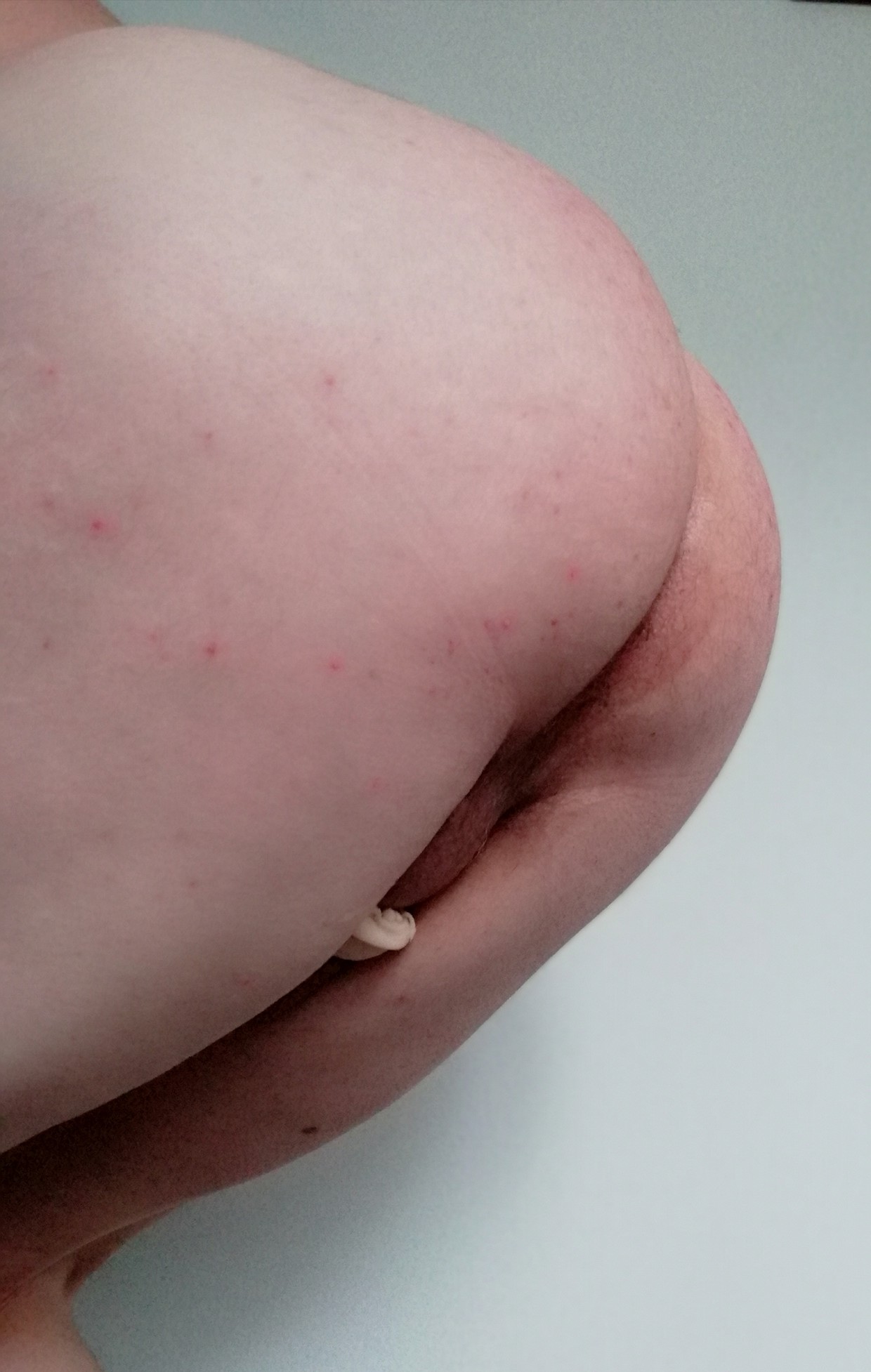 Me ass