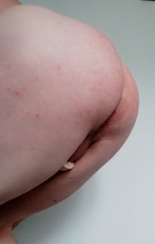 Me ass