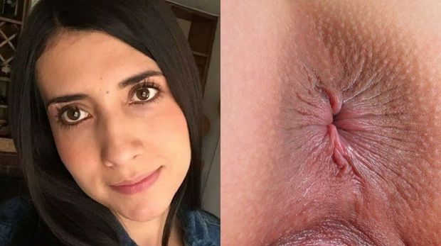 Anus Jenni