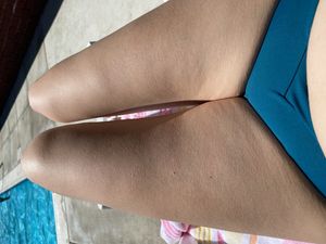 Need a little sun on these legs