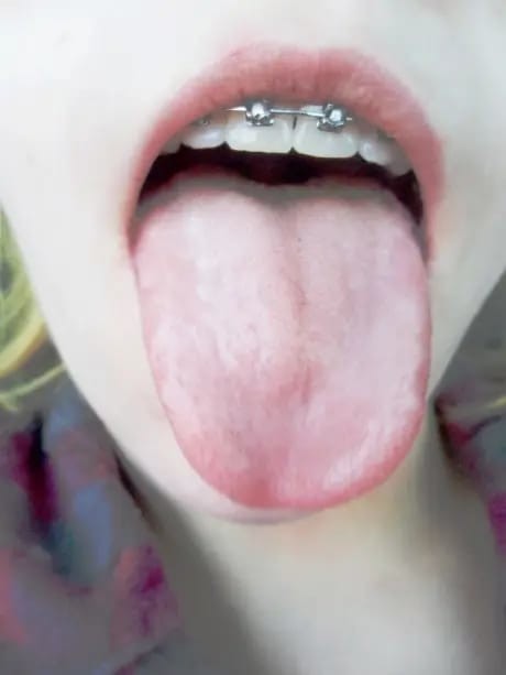 5.