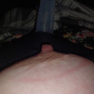 After elastic tied nipples in pump