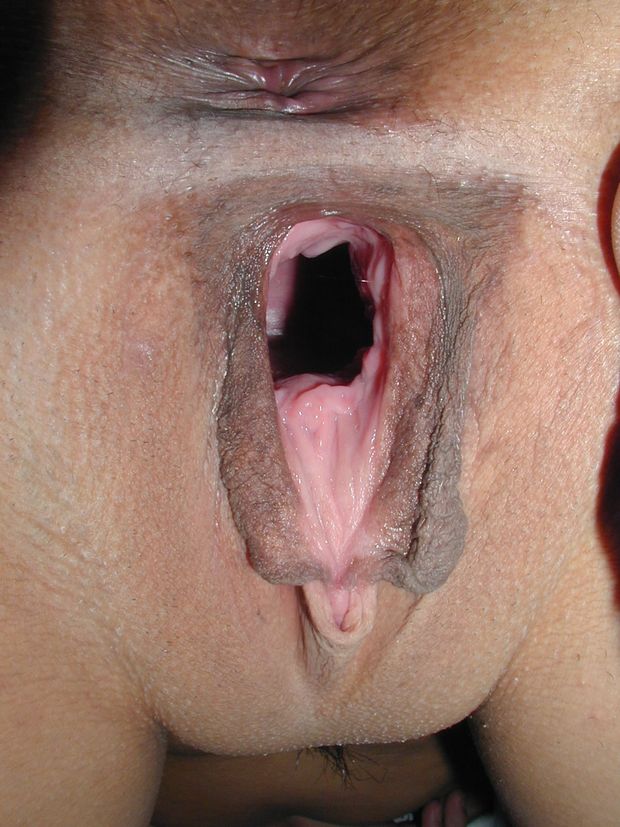 Pussy gape