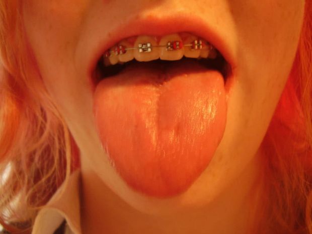 20.