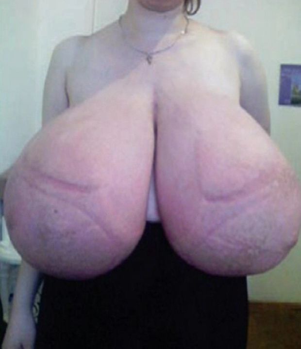 Giant Tits
