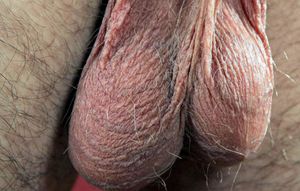 There's hair on them balls