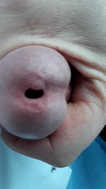 gapping penis hole