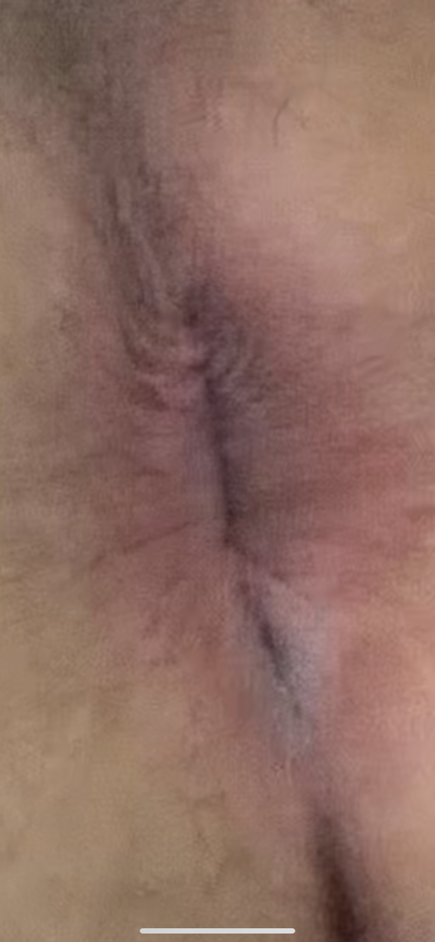 ass ass ass