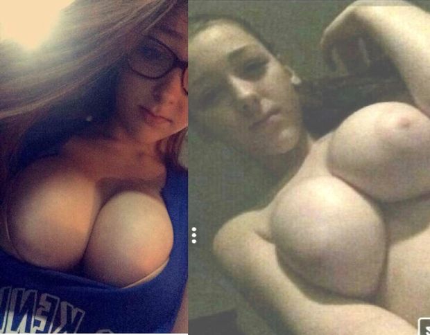 before after
