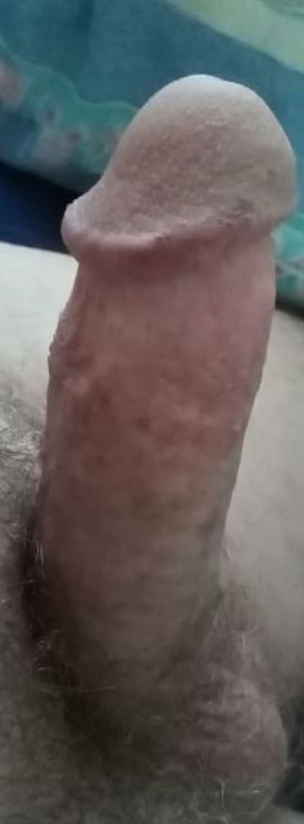 HAIRY