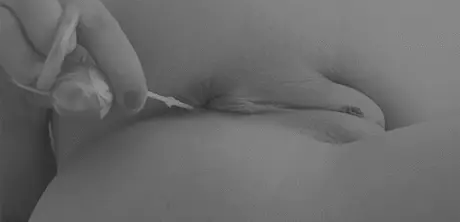 Anal beads