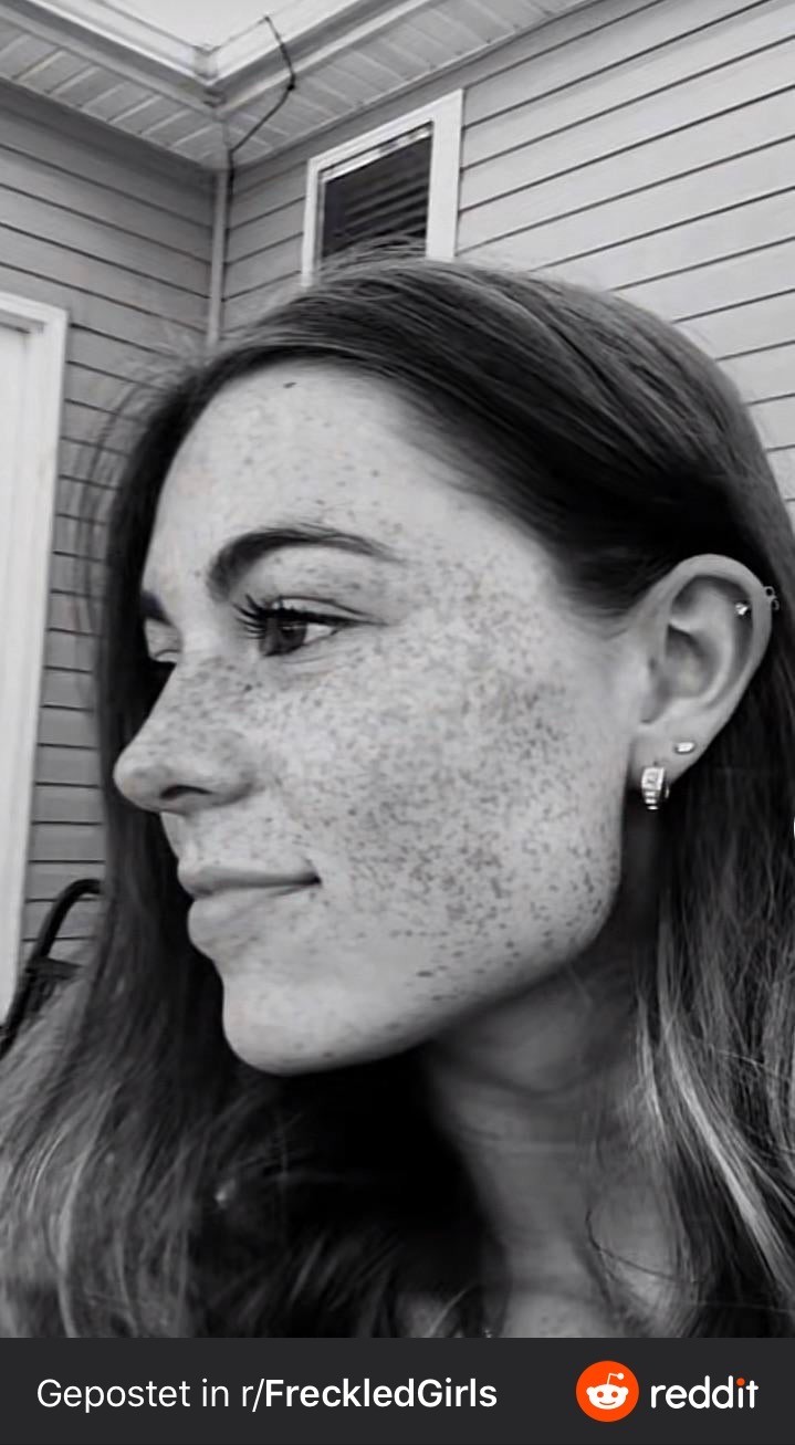 Do you like my freckles?