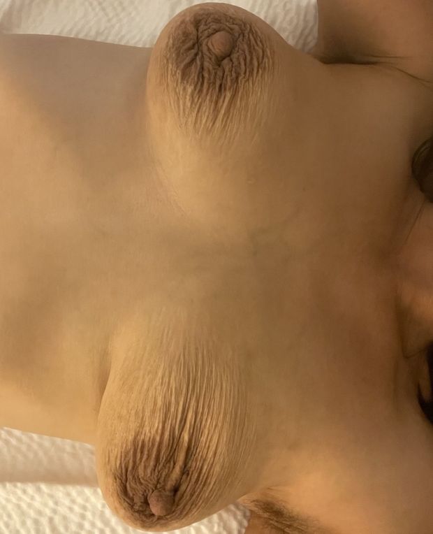 Wrinkled Nipples