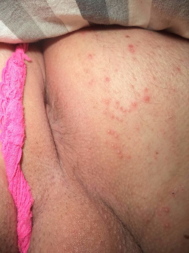 My beaty asshole