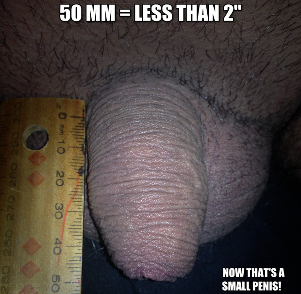 Ken my husbands small peenis