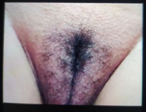 Pitudo666 Picture