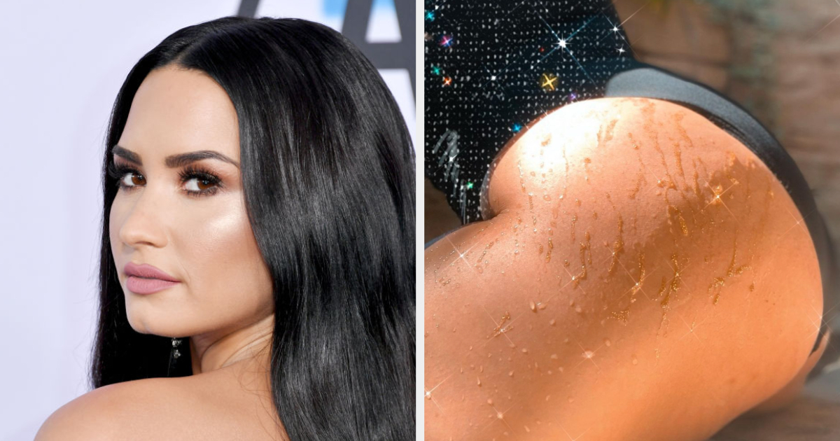 Demi Lovato Stretch Marks
