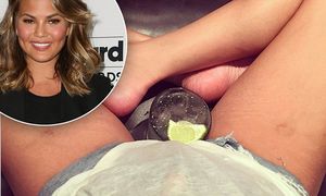 Chrissy Teigen displays her stretch marks