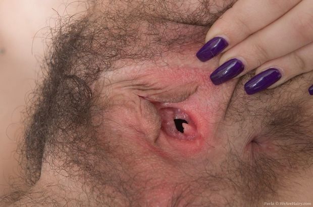 Hairy gaping holes