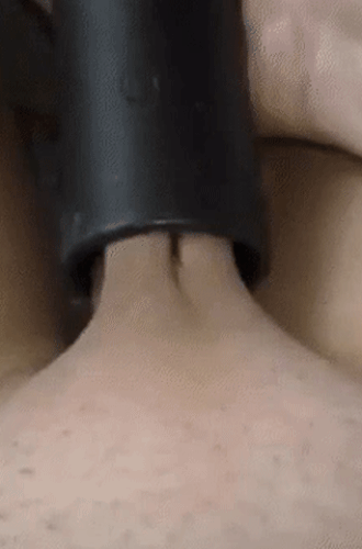 Suction