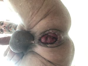 anal opening after big insertion