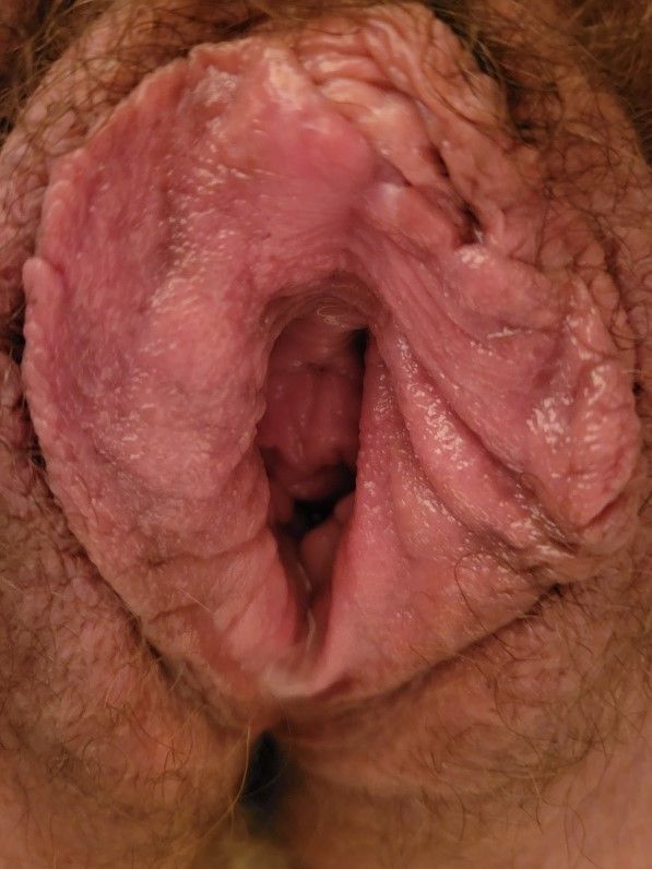 open and ready