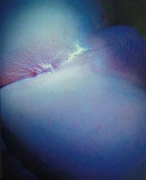 Do you want this tiny pink hole?