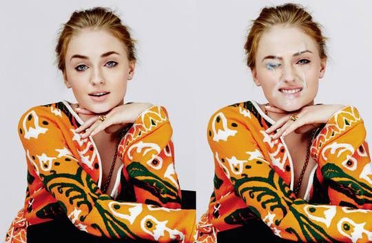 Sophie Turner Before & After