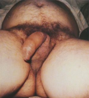 Hot married Daddy with long thick forskin,I used to suck regularly! Lots of sperm to swallow and lots of foreskin to suck and chew on! Mmmm!