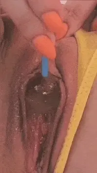 Follow the lolipop