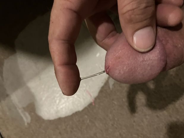 Starting to ooze