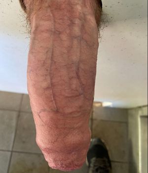 Hooded glory hole cock