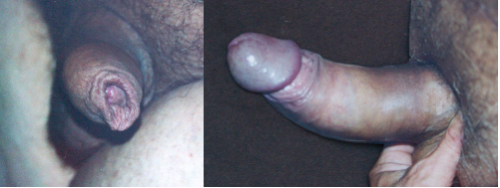 A big chubby old friend I use to suck off regularly! Suck and chewed his foreskin to get him real hard and cum in my mouth! Mmmmm! So good!