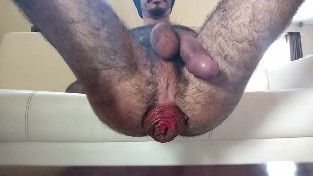 Beautiful hairy guy showing his amazing prolapse