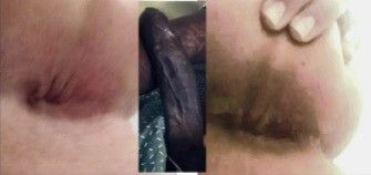 My hole before and after