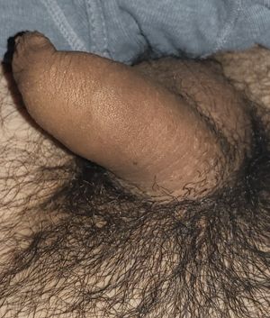 My tiny penis