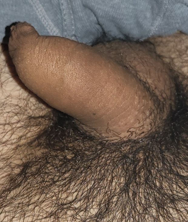 My tiny penis