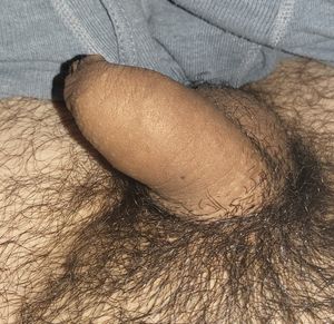 My tiny penis