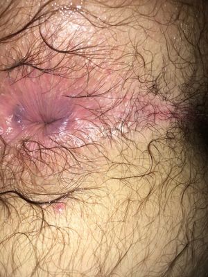 Delicious hairy anus to lick, suck and fuck it really good