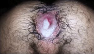 Delicious hairy mancunt leaking the sperm that was shot into it